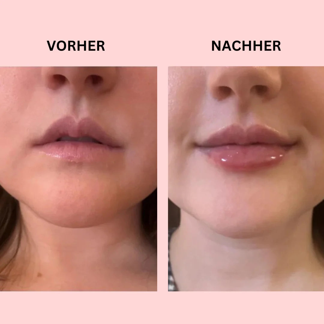 Lip Boost Set